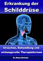 Erkrankung der Schilddrüse – Ursachen, Behandlung und wirkungsvolle Therapieformen