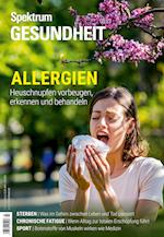 Spektrum Gesundheit - Allergien