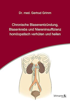 Chronische Blasenentzündung, Blasenkrebs und Niereninsuffizienz - homöopatisch verhüten und heilen