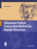 Glissonean Pedicle Transection Method for Hepatic Resection