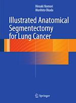 Illustrated Anatomical Segmentectomy for Lung Cancer