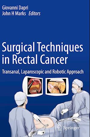 Surgical Techniques in Rectal Cancer