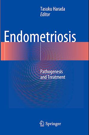 Endometriosis