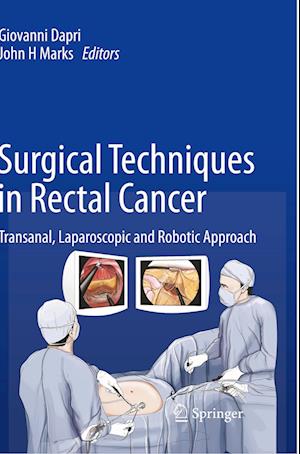 Surgical Techniques in Rectal Cancer