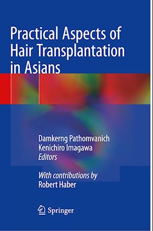 Practical Aspects of Hair Transplantation in Asians