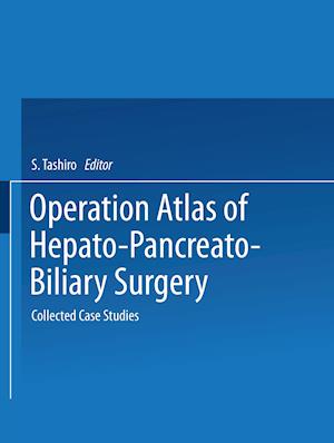 Operation Atlas of Hepato-Pancreato-Biliary Surgery