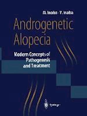 Androgenetic Alopecia