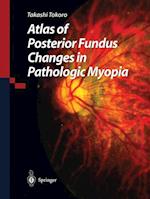 Atlas of Posterior Fundus Changes in Pathologic Myopia