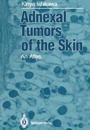 Adnexal Tumors of the Skin