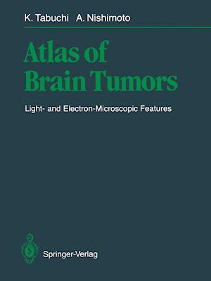 Atlas of Brain Tumors