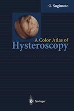 Color Atlas of Hysteroscopy