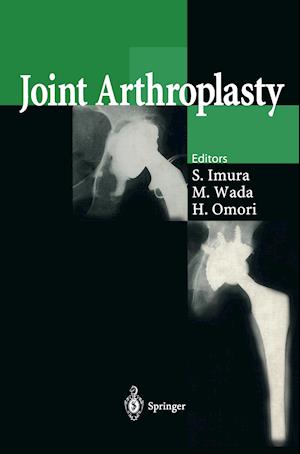 Joint Arthroplasty