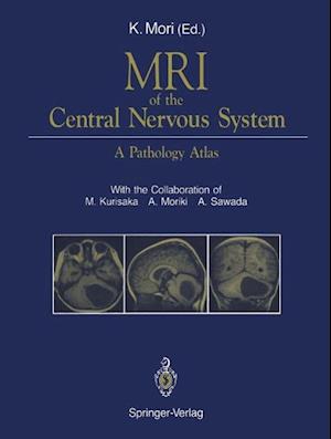 MRI of the Central Nervous System