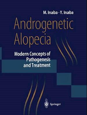 Androgenetic Alopecia