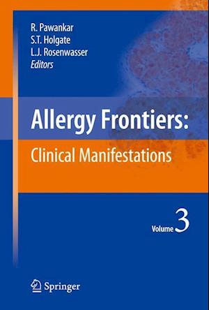 Allergy Frontiers:Clinical Manifestations