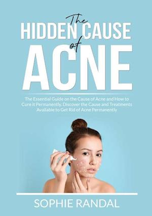 The Hidden Cause of Acne