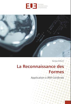 La Reconnaissance Des Formes