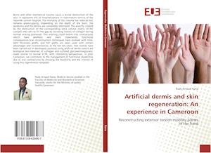Artificial dermis and skin regeneration: An experience in Cameroon