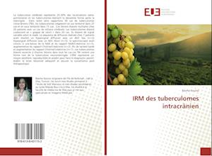 IRM des tuberculomes intracrânien