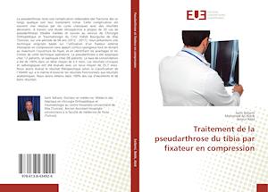 Traitement de la pseudarthrose du tibia par fixateur en compression