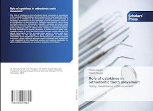 Role of cytokines in orthodontic tooth movement