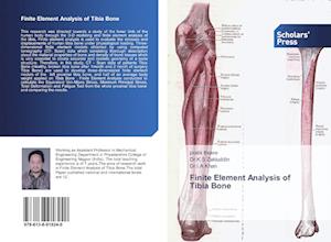 Finite Element Analysis of Tibia Bone