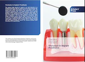 Occlusion In Implant Prosthesis