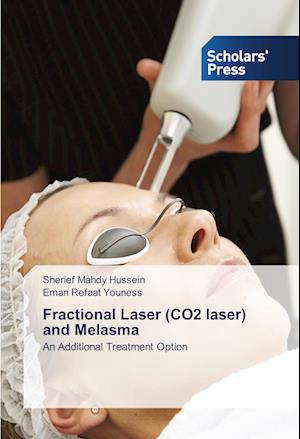 Fractional Laser (CO2 laser) and Melasma