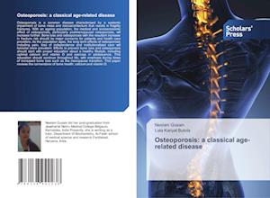 Osteoporosis: a classical age-related disease