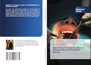 Implant as Treatment option in Rehabilitation of Posterior Maxilla