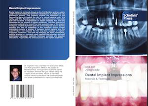 Dental Implant Impressions