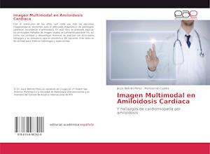 Imagen Multimodal en Amiloidosis Cardíaca