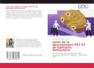 Valor de la Neuroimagen PET CT de Epilepsia Refractaria