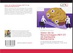 Valor de la Neuroimagen PET CT de Epilepsia Refractaria