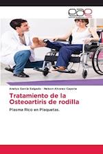 Tratamiento de la Osteoartiris de rodilla