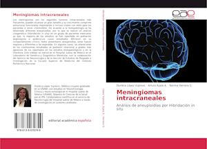 Meningiomas intracraneales