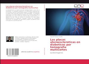 Las placas ateroescleroticas en diabeticos por tomografia multicortes