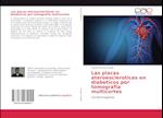 Las placas ateroescleroticas en diabeticos por tomografia multicortes