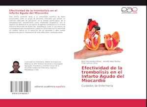 Efectividad de la trombolisis en el Infarto Agudo del Miocardio