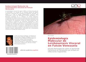 Epidemiología Molecular de Leishmaniasis Visceral en Falcón Venezuela