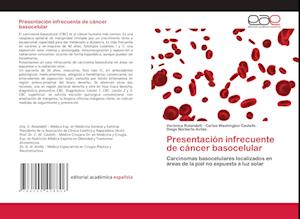 Presentación infrecuente de cáncer basocelular