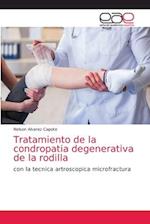 Tratamiento de la condropatia degenerativa de la rodilla