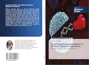 B cell specificity and pattern in primary Sjögren's syndrome