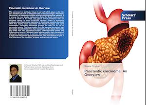 Pancreatic carcinoma: An Overview