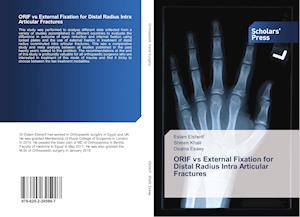 ORIF vs External Fixation for Distal Radius Intra Articular Fractures