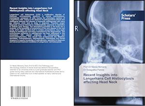 Recent Insights into Langerhans Cell Histiocytosis affecting Head Neck