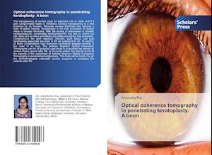 Optical coherence tomography in penetrating keratoplasty: A boon