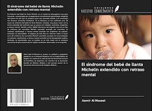 El síndrome del bebé de llanta Michelin extendido con retraso mental