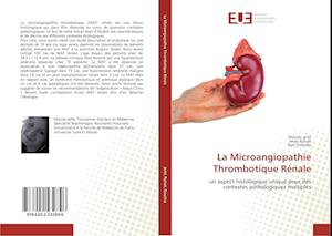 La Microangiopathie Thrombotique Rénale