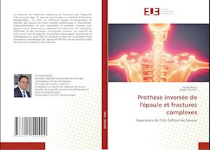 Prothèse inversée de l'épaule et fractures complexes